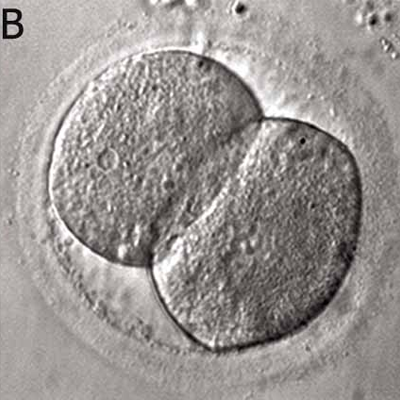 2-cell-embryo.png